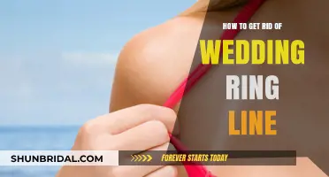 Erase the Tan Line: Quick Tips to Remove Wedding Ring Marks