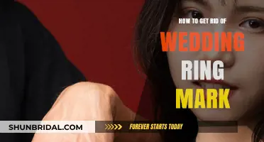 Erase Wedding Ring Marks: Quick and Easy Solutions