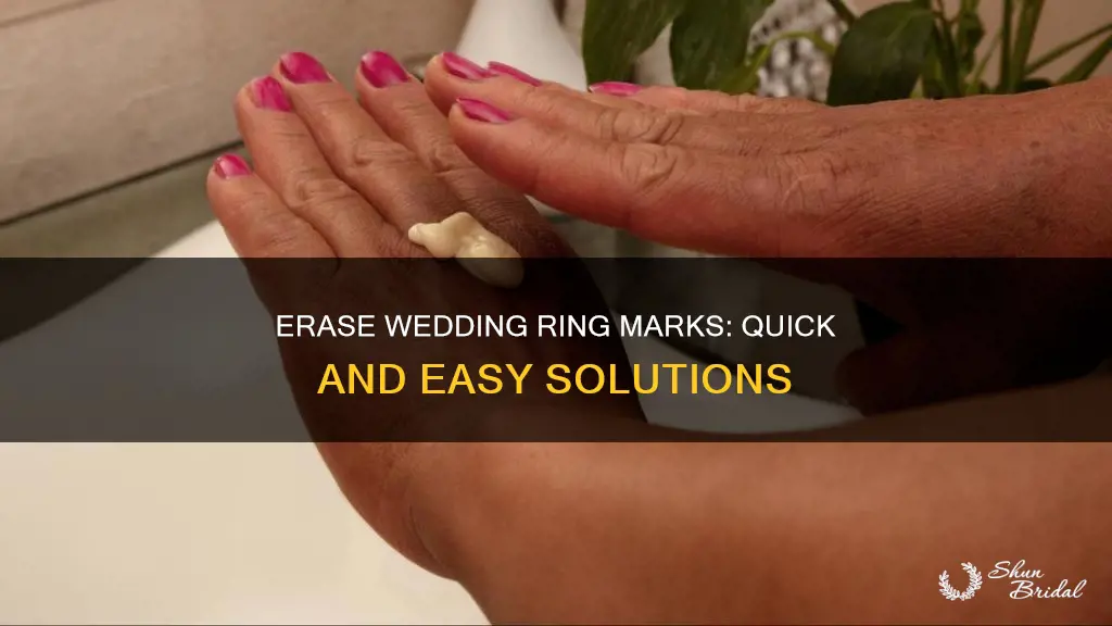 how to get rid of wedding ring mark