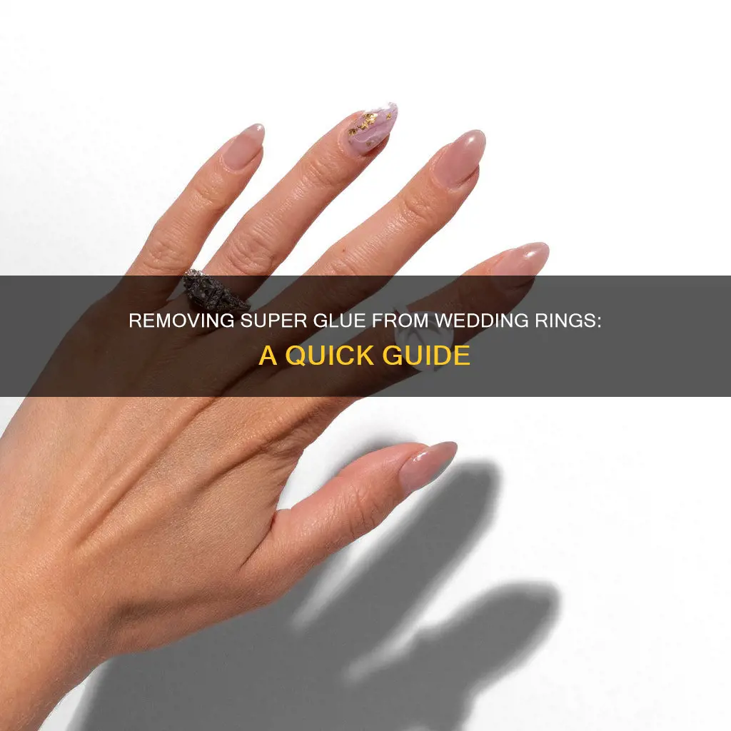 how to get super glue off wedding ring