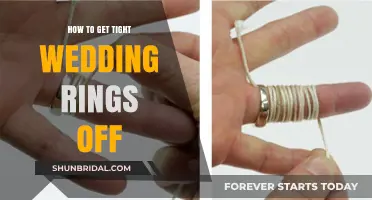 Removing Tight Wedding Rings: Quick and Safe Methods