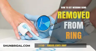 Removing Wedding Bands: Quick and Safe Methods