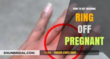 Removing Wedding Rings: Pregnancy Tips