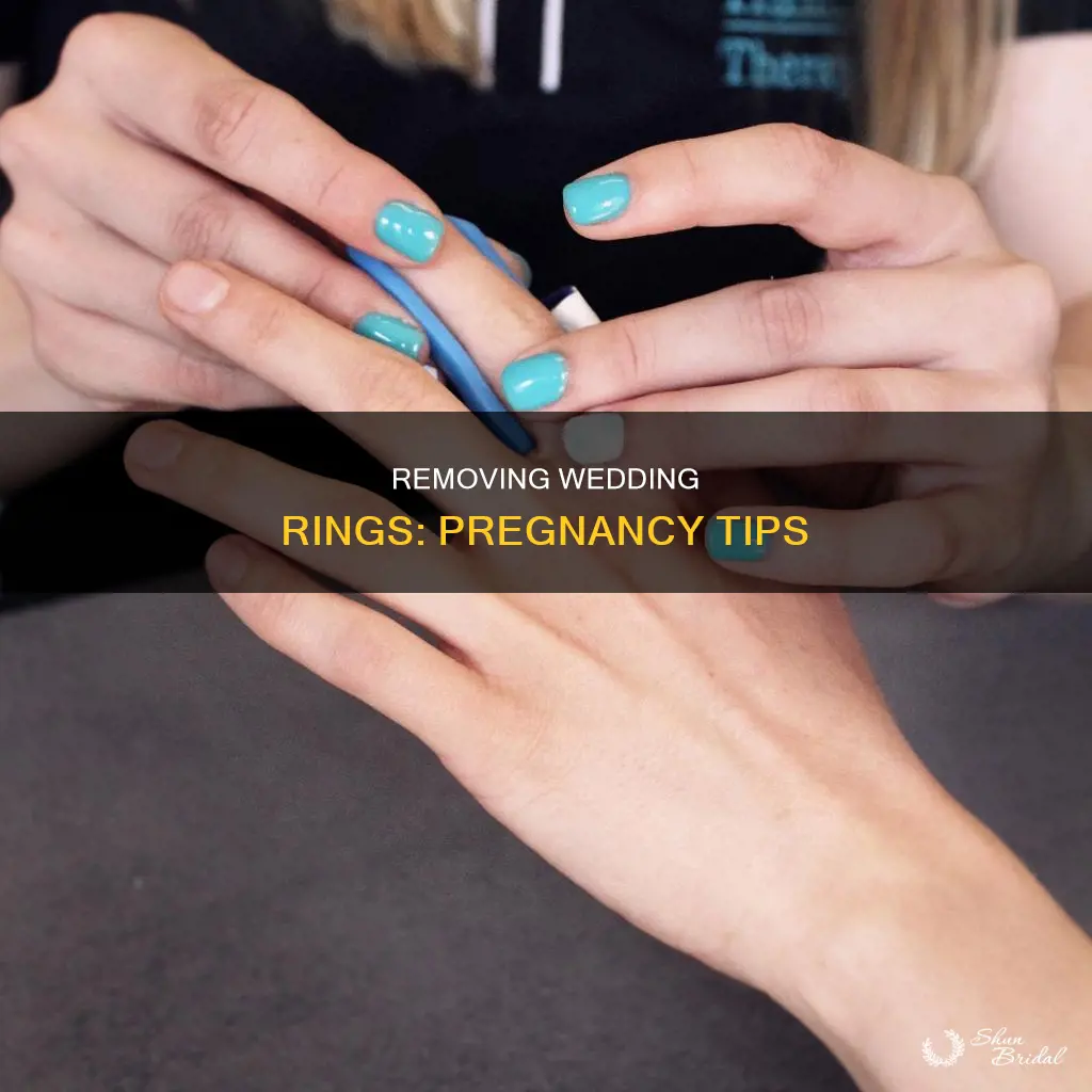 how to get wedding ring off pregnant