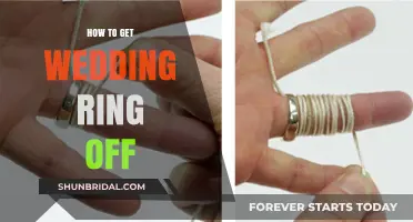 Removing Your Wedding Ring: Quick and Safe Methods