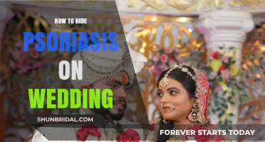 Flawless Wedding Skin: Expert Tips to Conceal Psoriasis on Your Big Day