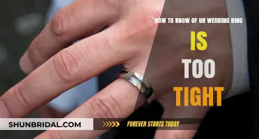 Wedding Ring Too Tight? Here's How to Know