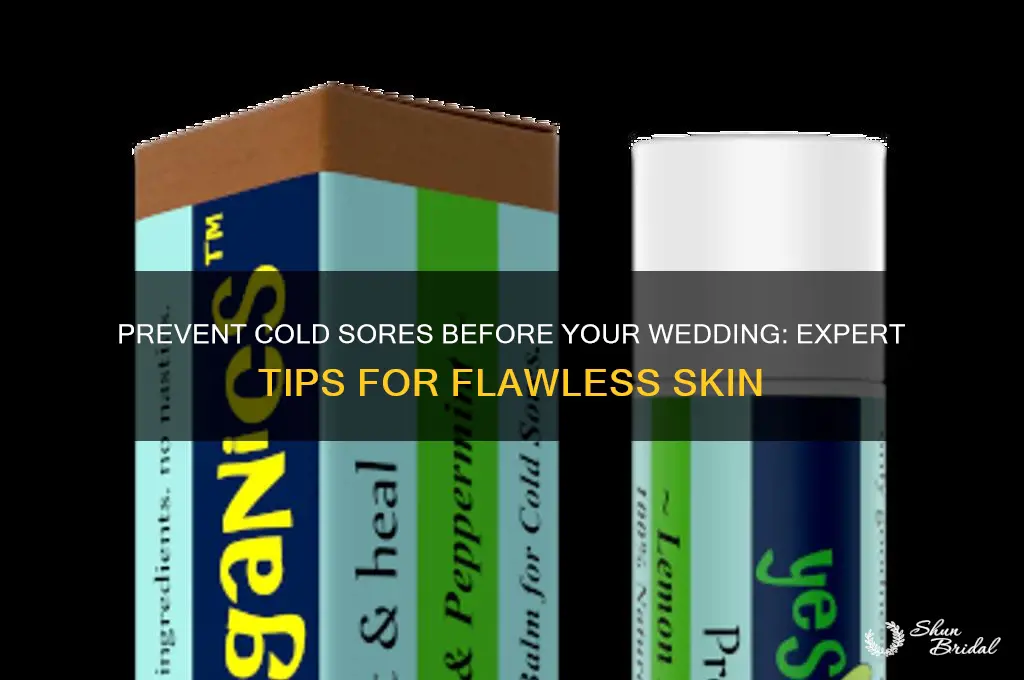 how to prevent cold sores before wedding
