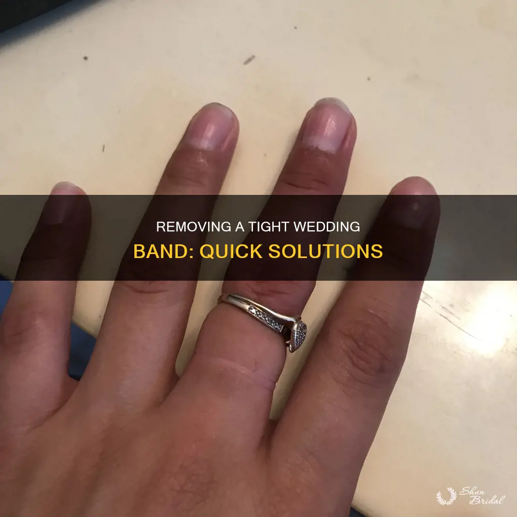 how to remove a tight wedding band