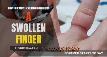 Relieve Swollen Fingers: Remove Wedding Band