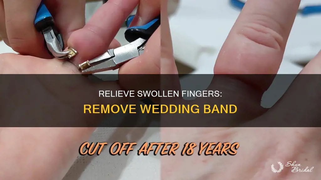 how to remove a wedding band from a swollen finger