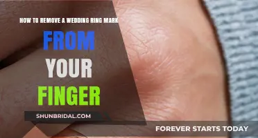 Erase Wedding Ring Marks: Quick and Easy Solutions