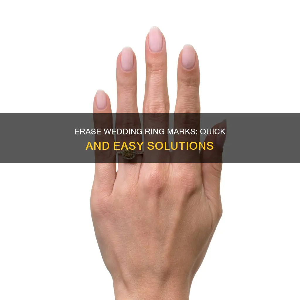 how to remove a wedding ring mark from your finger