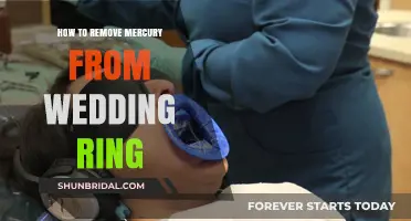 The Safe Way to Remove Mercury from Wedding Rings