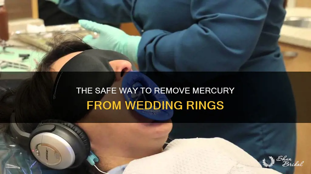 how to remove mercury from wedding ring