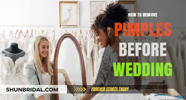 Quick Wedding Acne Fixes: Clear Skin Tips for Your Big Day