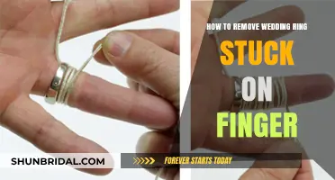 Removing Stuck Wedding Rings: Quick and Safe Methods