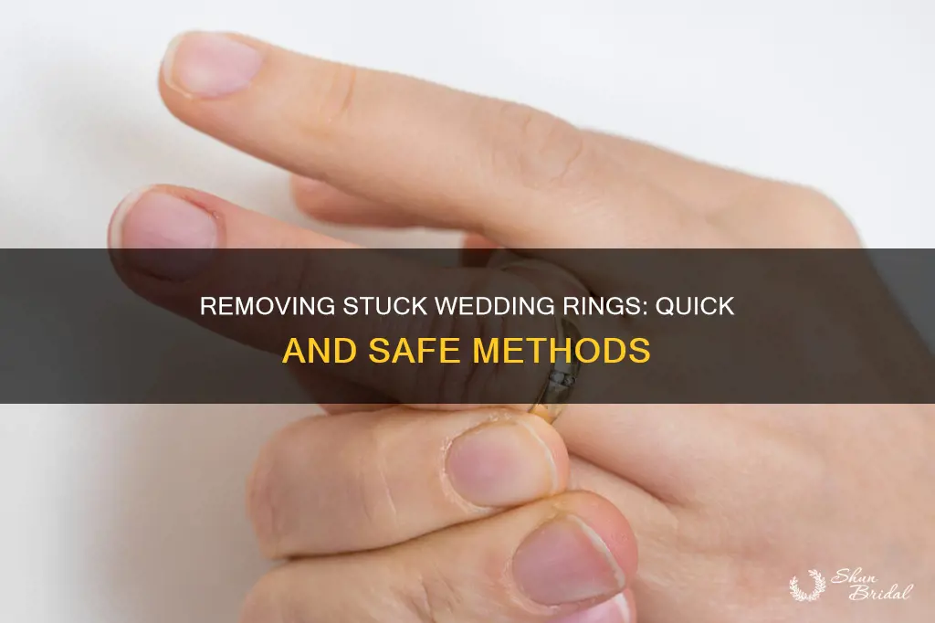 how to remove wedding ring stuck on finger