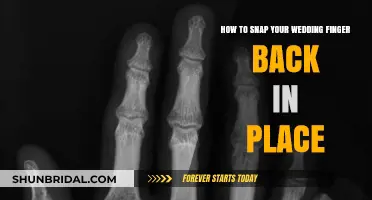 Quick Fix: How to Snap Your Wedding Finger Back in Place