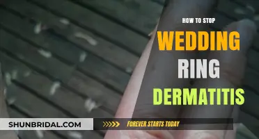 Preventing Wedding Ring Dermatitis: Tips for Brides and Grooms