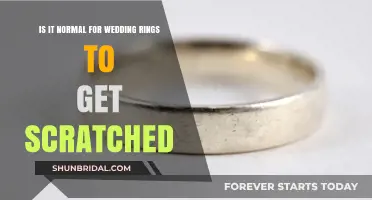 Wedding Ring Scratches: Normal or Not?