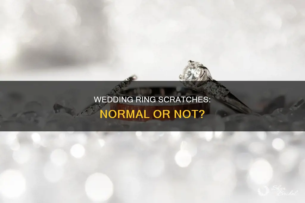 is it normal for wedding rings to get scratched