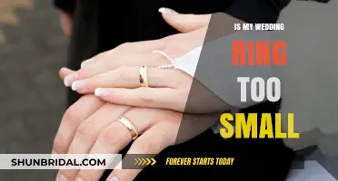 Wedding Ring Woes: Is My Band Too Tight?
