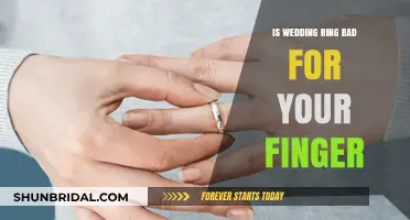 Wedding Rings: Harmful or Healthy for Fingers?