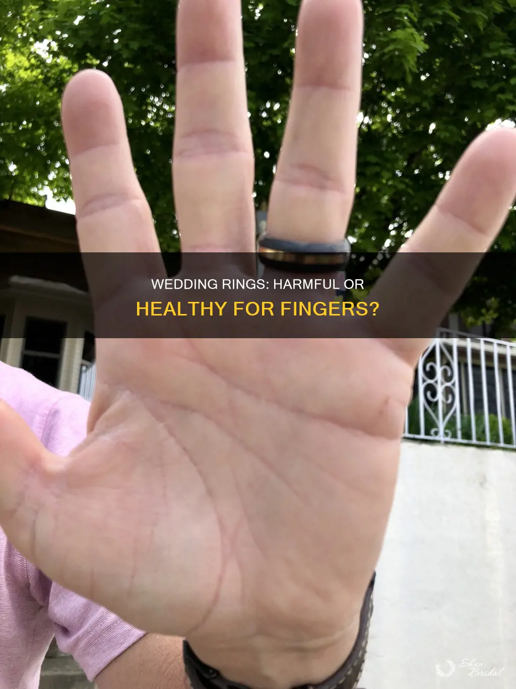 is wedding ring bad for your finger