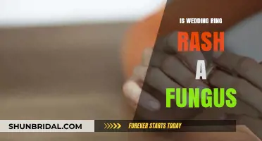 Wedding Ring Rash: Fungal or Allergic Reaction?