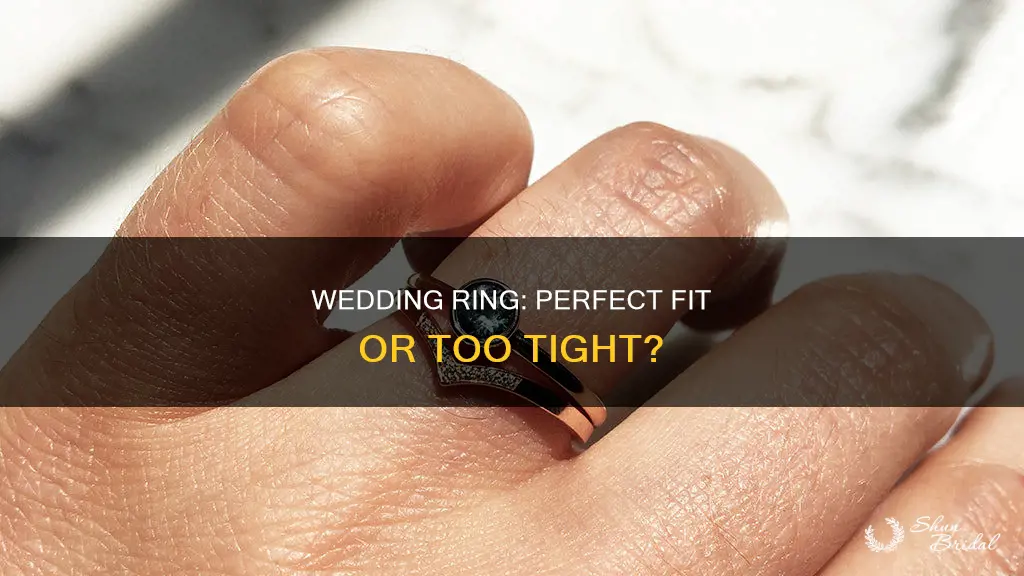 should a wedding ring be tight
