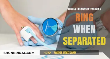 When Separated, Remove Your Wedding Ring?