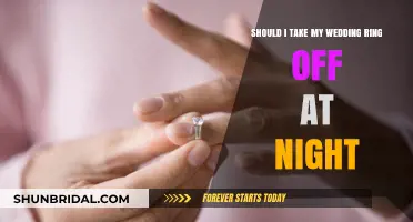 Nighttime Wedding Ring: To Remove or Not?