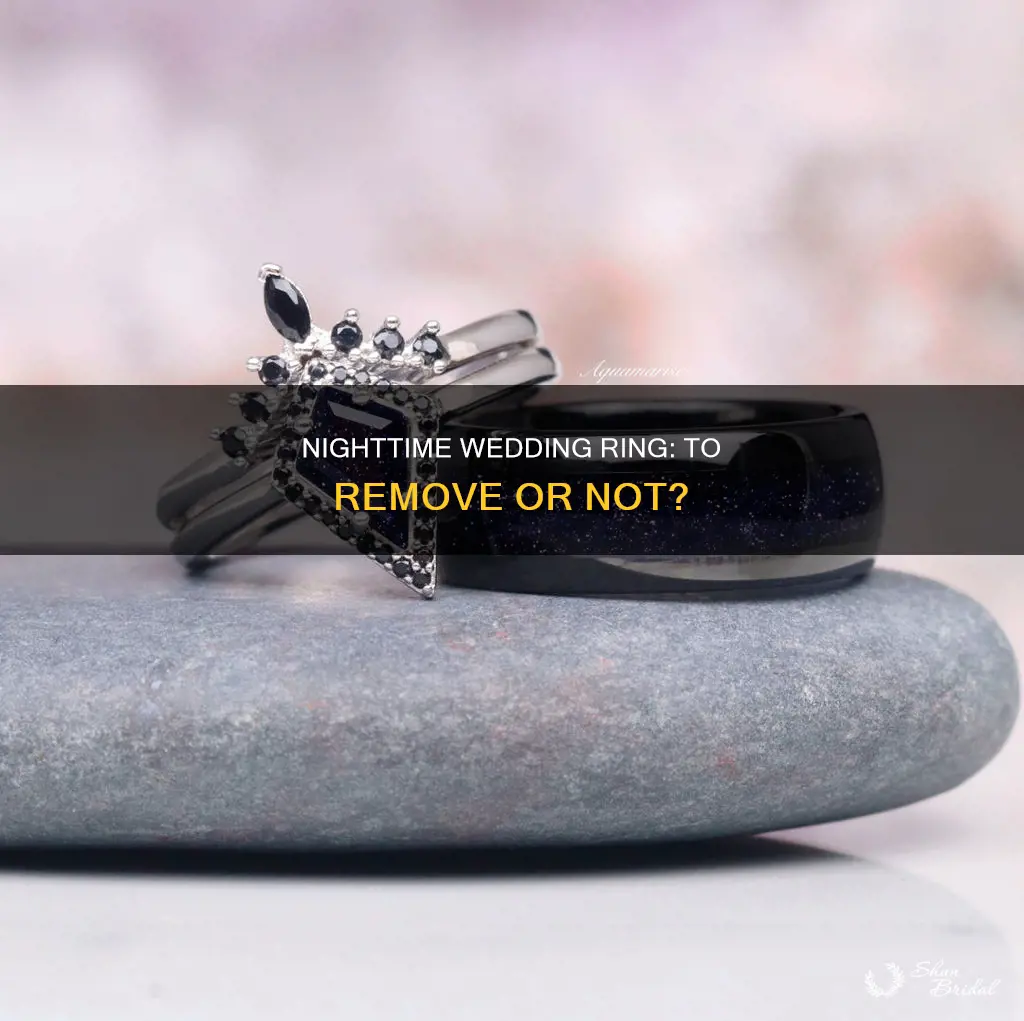 should I take my wedding ring off at night