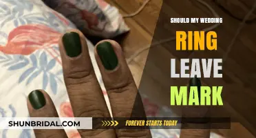 Wedding Ring Marks: What's Normal?