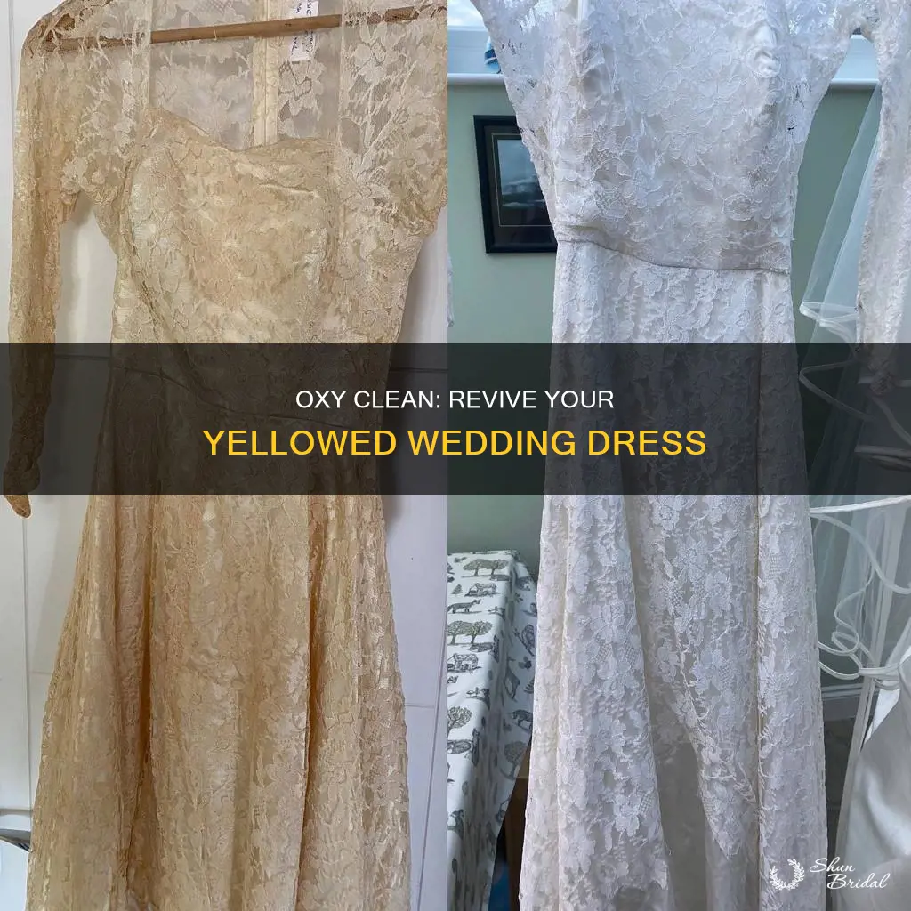 should use oxy clean yellowed wedding dress