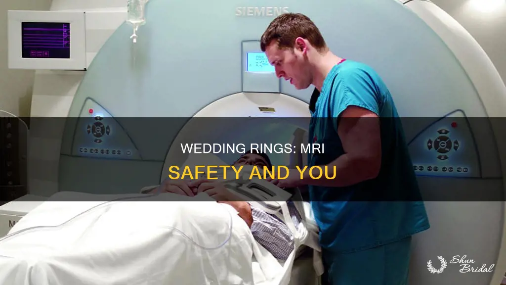 should wedding rings be taken off during mri