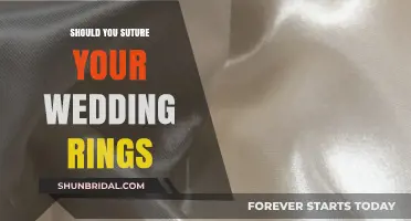 The Forever Commitment: Suturing Wedding Rings