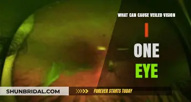 Veiled Vision in One Eye: Causes and Concerns Explained