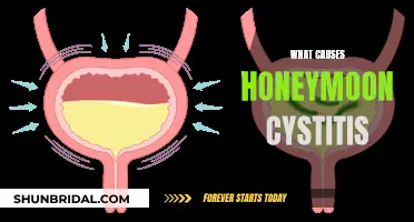 Unraveling the Mystery: Why Honeymoon Cystitis Strikes