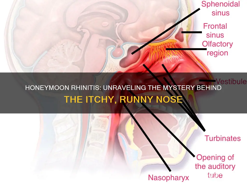 what causes honeymoon rhinitis