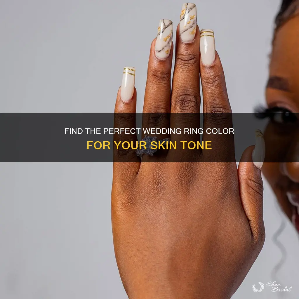 what color wedding ring looks best on hrien skin