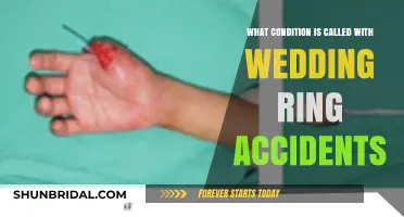 Wedding Ring Syndrome: Injuries Caused by Jewelry