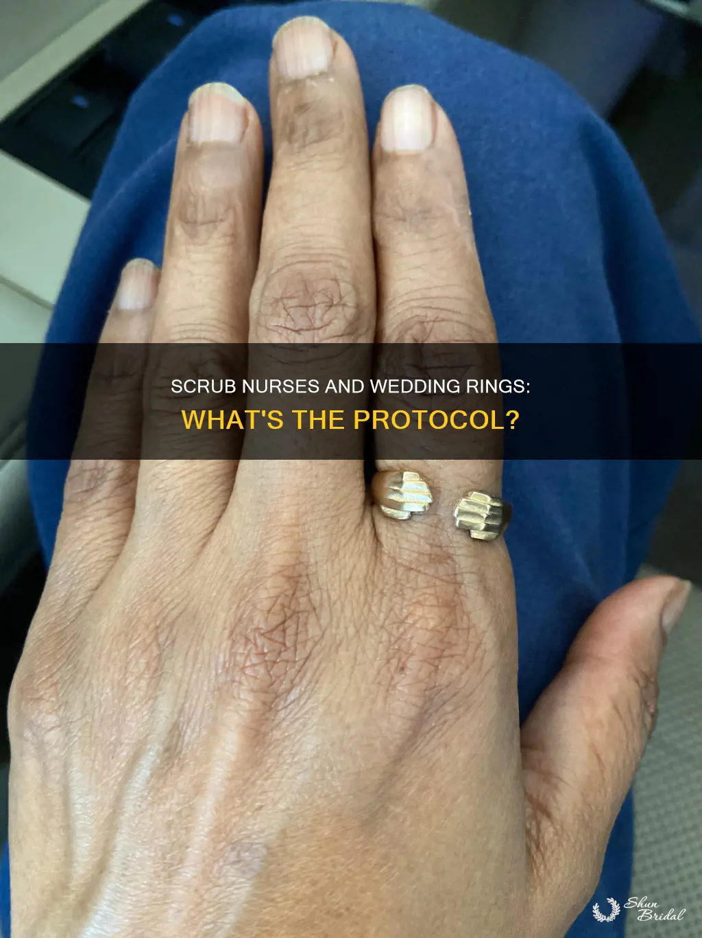 what do scrub nurses do with wedding rings