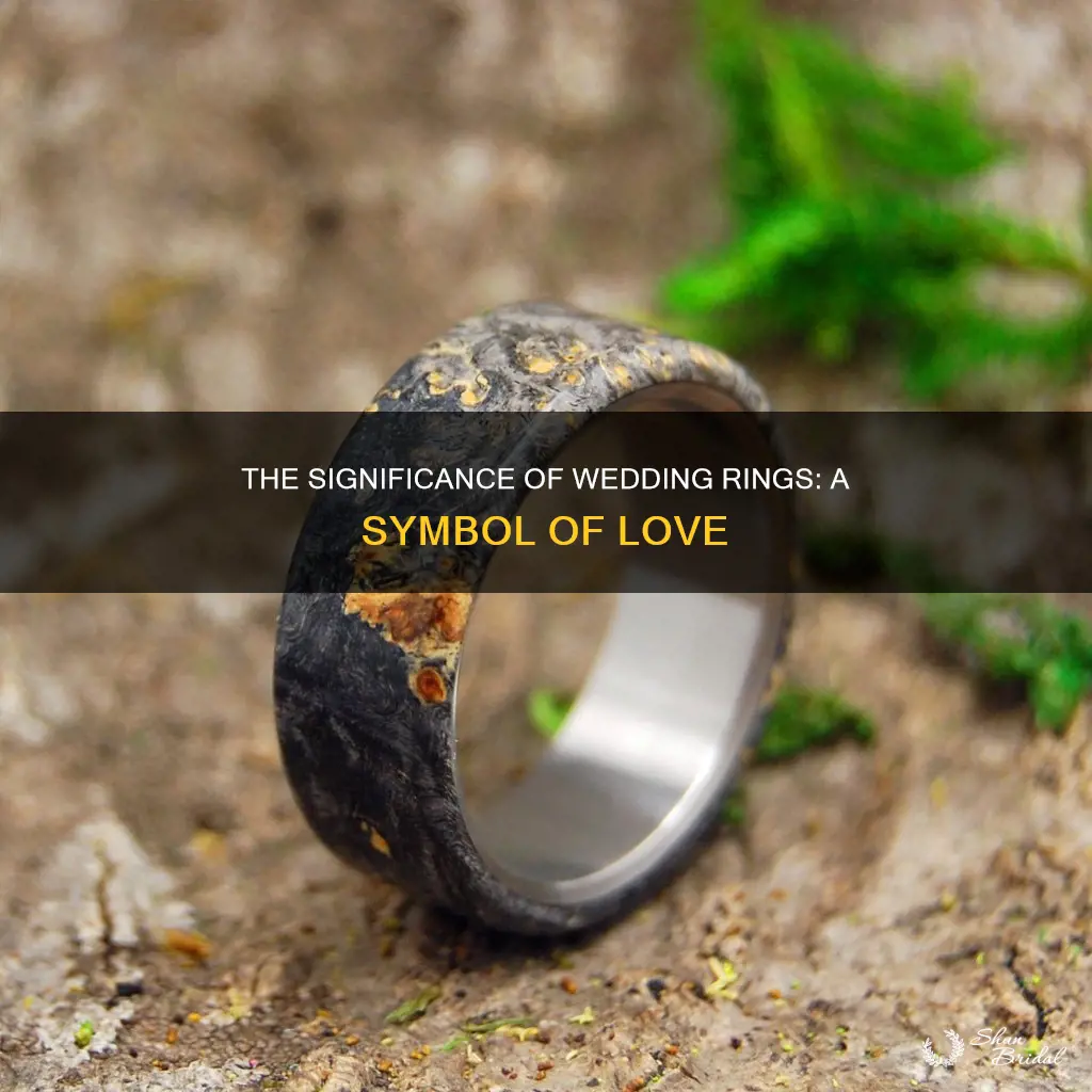 what does a wedding ring look like