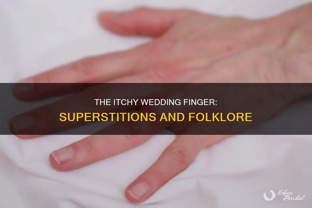 what does it mean if your wedding finger itches