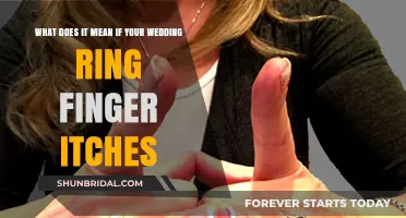 Superstitions and Meanings Behind an Itchy Wedding Ring Finger