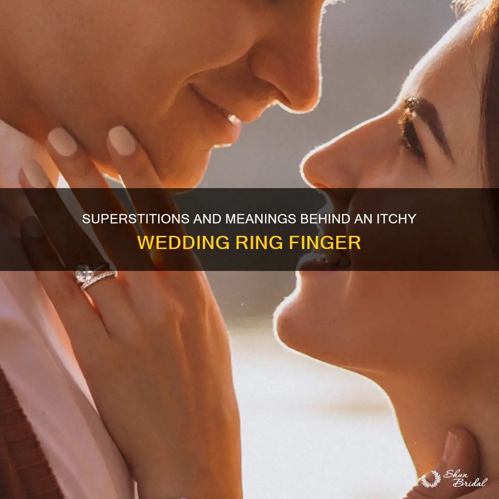 what does it mean if your wedding ring finger itches