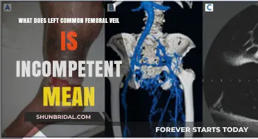 Understanding Incompetent Left Common Femoral Vein: Causes, Symptoms, and Treatment