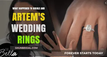 Where Are Nicole and Artem's Wedding Rings?